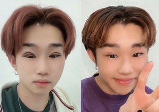 “ノリでやった”4度の二重整形に「後悔はありません」、カジュアル化が広がるも