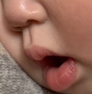 1歳娘の人中が長い気がする‥