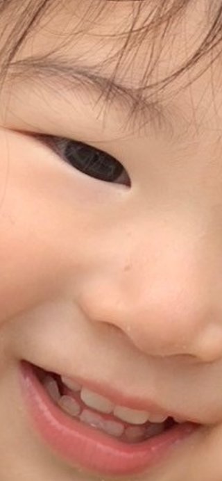2歳の娘の歯並びなんですが、これって出っ歯ですか？