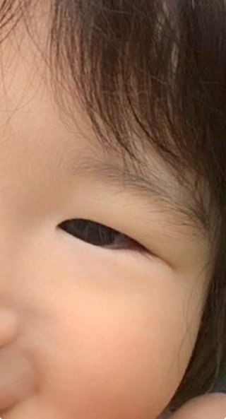 2歳の娘の歯並びなんですが、これって出っ歯ですか？