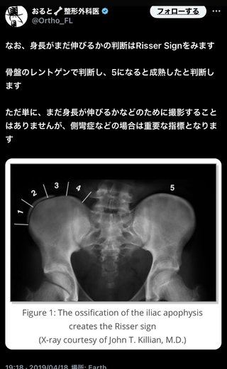 生理きても身長伸び続けた子いる？