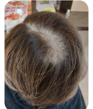 白髪を放置してる人って