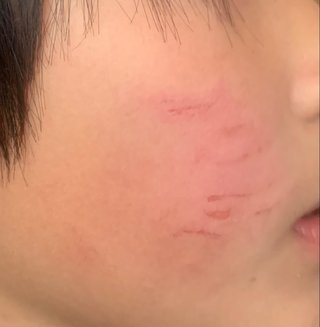 子供が殴られたらしい