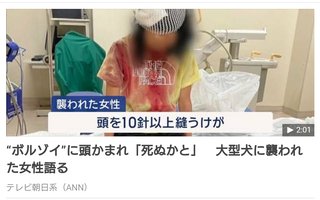 “ボルゾイ”に頭かまれ「死ぬかと」　大型犬に襲われた女性語る