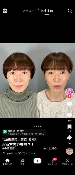 ２００万の整形でここまで綺麗になるんだね