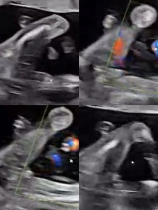 性別判断お願いします！