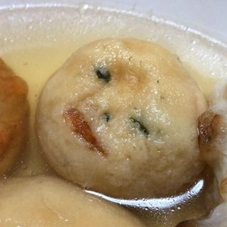 2歳の娘の歯並びなんですが、これって出っ歯ですか？