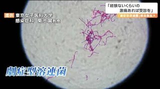 致死率30％の“劇症型溶連菌”　全国で感染拡大