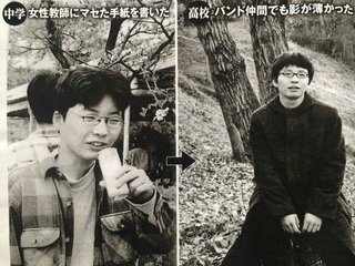 整形？