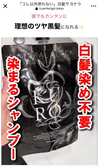 白髪【総合】情報交換・愚痴