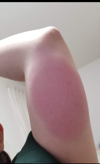 インフルエンザのワクチンてさ