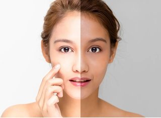 世界美白製品市場は2032年までに159億8000万ドルに達する