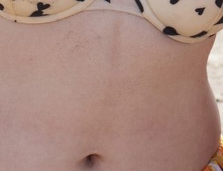 こういうおなかって普通なの？