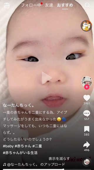 赤ちゃんにアイプチするママ