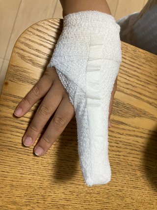 突き指って病院行くの？