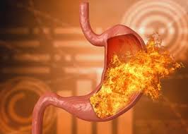 日本消化性潰瘍薬市場は2032年までに1億2170万米ドルへ