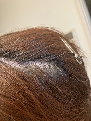 41歳でこの白髪ヤバい？