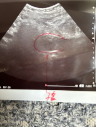 妊娠してるか詳しい人