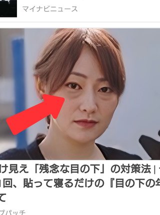 目の下こうなってる人多くない？