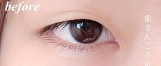 ブスが絶滅危惧種みたいになってきてない？