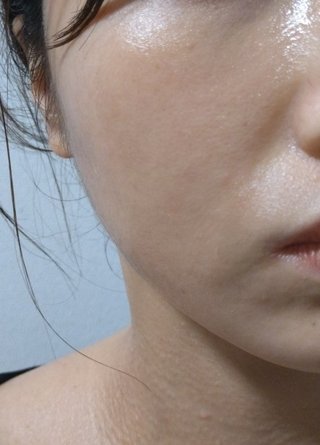 口元の小ジワについて