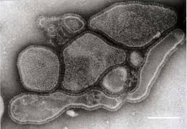 ｢ヒトメタニューモウイルス感染症｣中国で感染増… WHOは｢想定内｣