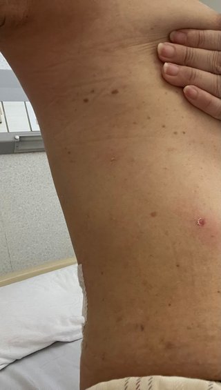 入院してたら劇的に肌が汚くなった