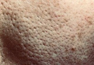 40代でこの肌質