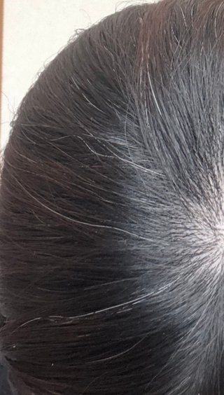 私って白髪かなりある方？