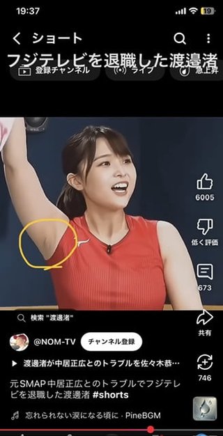 某女子アナ、豊胸疑惑の脇の傷