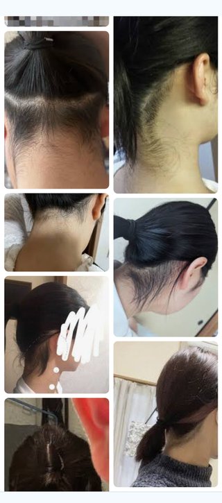 こういう毛深いうなじの人いる？