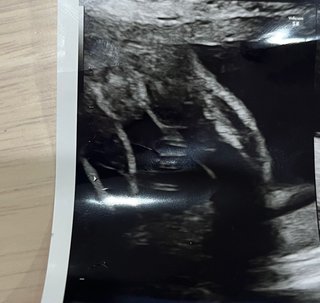 男の子？女の子？