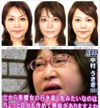 高梨沙羅、顔変わりすぎやな