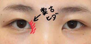 蒙古襞がある芸能人、誰がいますか？