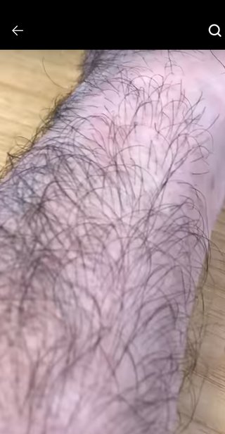 みんなは脱毛何ヶ月おき？
