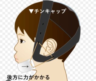 子供が受け口、矯正方法