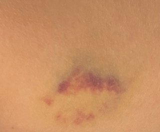 これって放置して大丈夫？