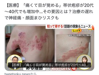 結局コロナワクチンは毒だったんだね