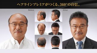 髪の悩みはある？