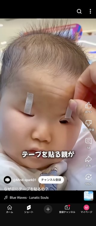 日本でも流行る赤ちゃんの瞼にテープ