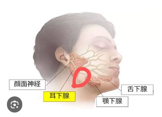 頬にしこりがある