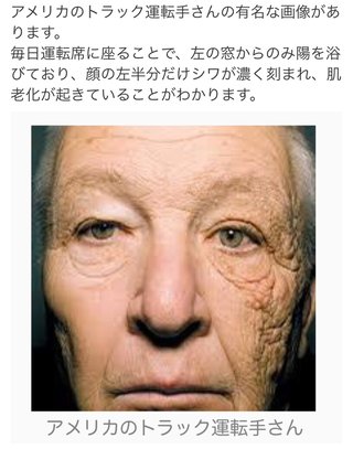 30前半。片方だけほうれい線くっきり