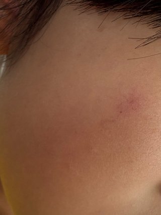 このレベルで皮膚科