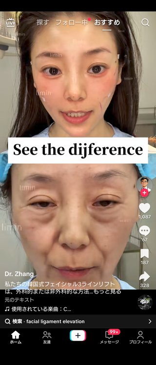 整形でここまで若返りするの？