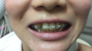 橘るみこ地域開放不倫してはモテてると勘違い