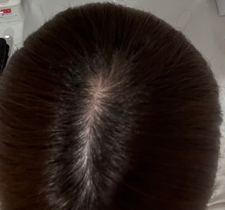 頭皮、これ薄い？まだ大丈夫？？