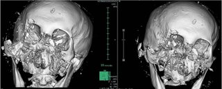 親子熊が公園で遊んでただけなのに追い払うとかヒドイ