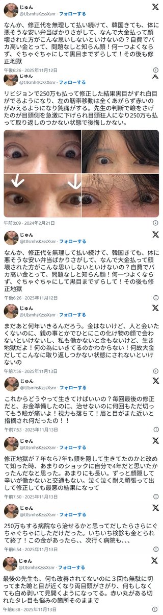 韓国で整形に3000万円かけて失敗した人のポスト､辛すぎると話題に【X】