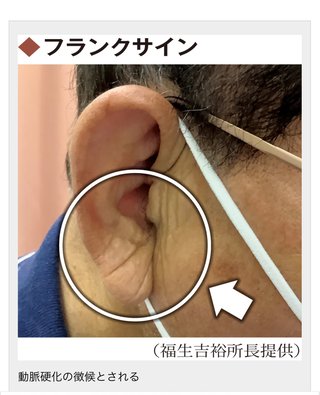 耳たぶにこのフランクサインある？？