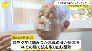 突如クマに襲われた80歳ハンター､顔面を咬まれるも反撃して射殺【新潟県】